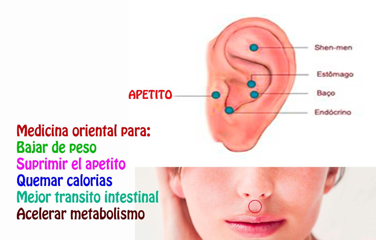 Imanes acupuntura para adelgazar