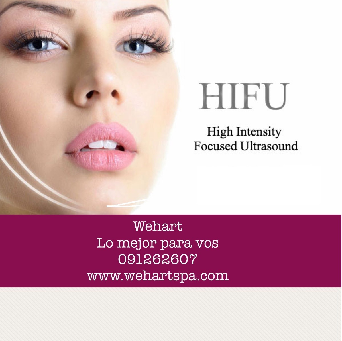 Hifu Facial O Corporal:*hifu*plasma*hilos*ac Hialuronico - $ 7.500,00