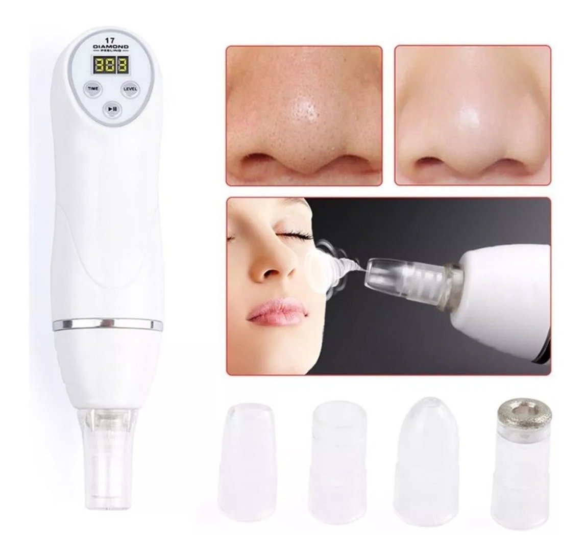 Micro Dermoabrasion Punta Diamante Peeling Puntos Negros - $ 2.890,00